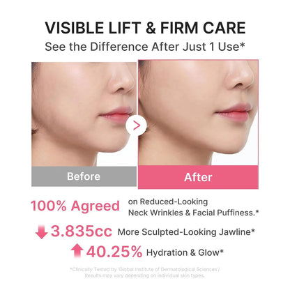 🦢Vividorge Neck Wrinkle Eraser! Built-In Gua Sha Cream w/5% Anemarrhena Root Complex + PDRN Korean Skincare